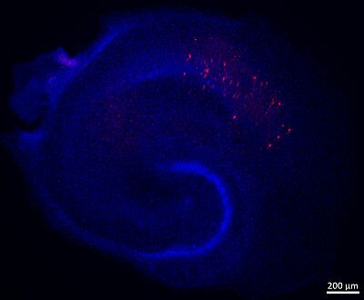 Culture organotypique hippocampique murine présentant au bout de deux semaines ex vivo une pathologie Tau au niveau de la CA1. L’ensemble des noyaux est marqué en bleu et la Tau pathologique en rouge.)