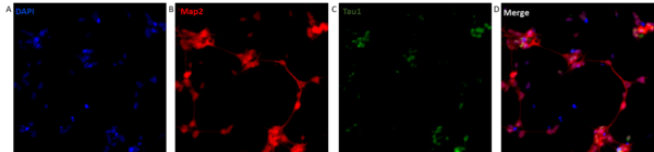 Caractérisation en immunofluorescence de neurones humains induits par conversion directe de fibroblastes via des miARN.