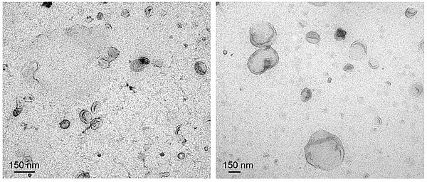 Microscopie électronique des petites vésicules extracellulaires (gauche) et grandes vésicules extracellulaires (droite).